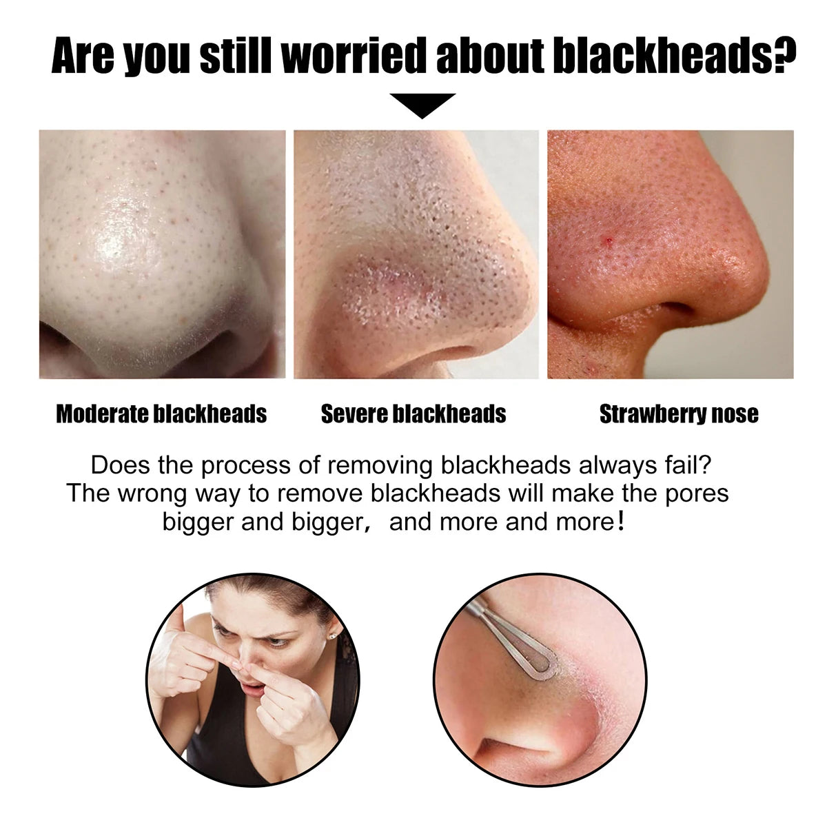 Blackhead Nose Patch – Deep Cleansing Pore Strip | HIP Blackhead Pore Strip HIP