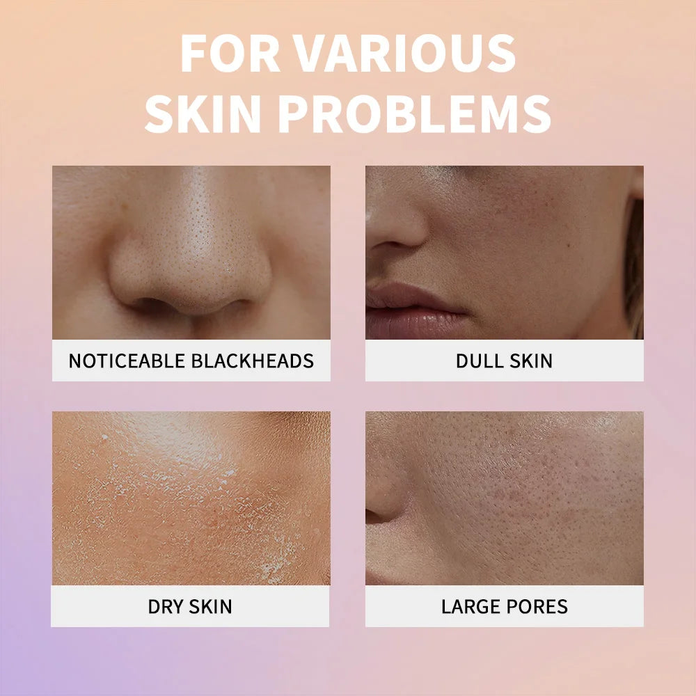 Rice Peeling Ampoule Soft Exfoliating Face and Body Scrub Dead Skin Cells Blackhead Remover for All Skin Types korean skin care HIP