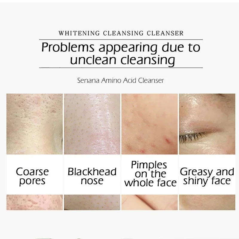 Nicotinamide Amino Acid Face Cleanser – Oil Control & Pores Facial Cleanser HIP