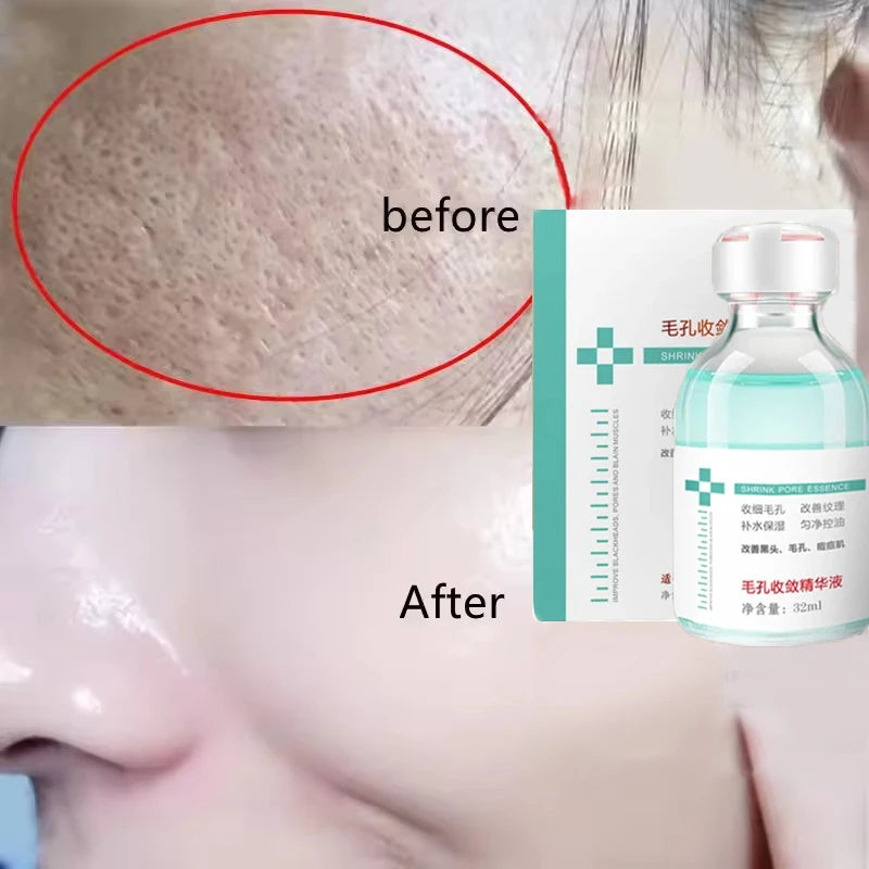 Lactic Acid Pore Minimizing Face Serum – Firm & Smooth Pore Minimizing Serum HIP