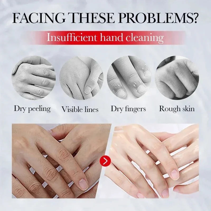 Kojic Acid Hand Cream – Brightening & Moisturizing | 30g Brightening Hand Cream HIP
