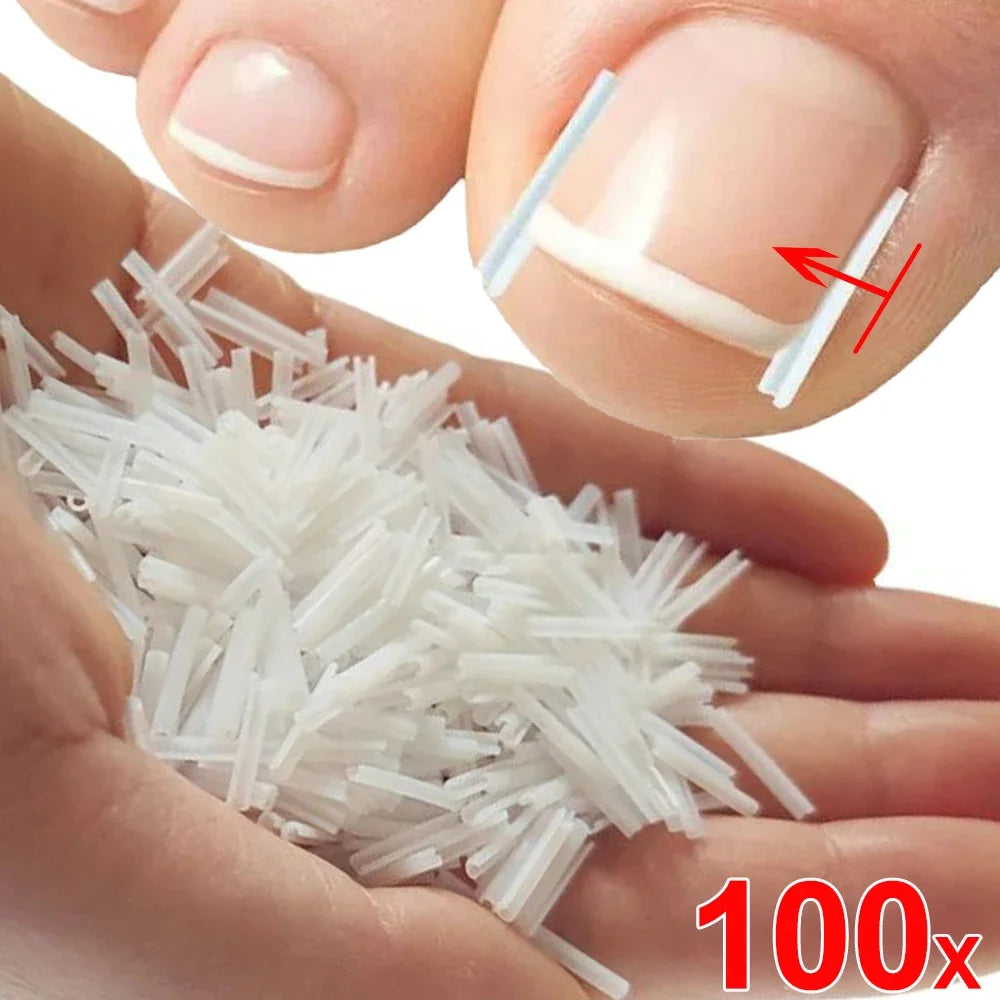 Ingrown Toenail Correction Patches – Ultra-Thin Elastic Stickers Toenail Correction Patch HIP