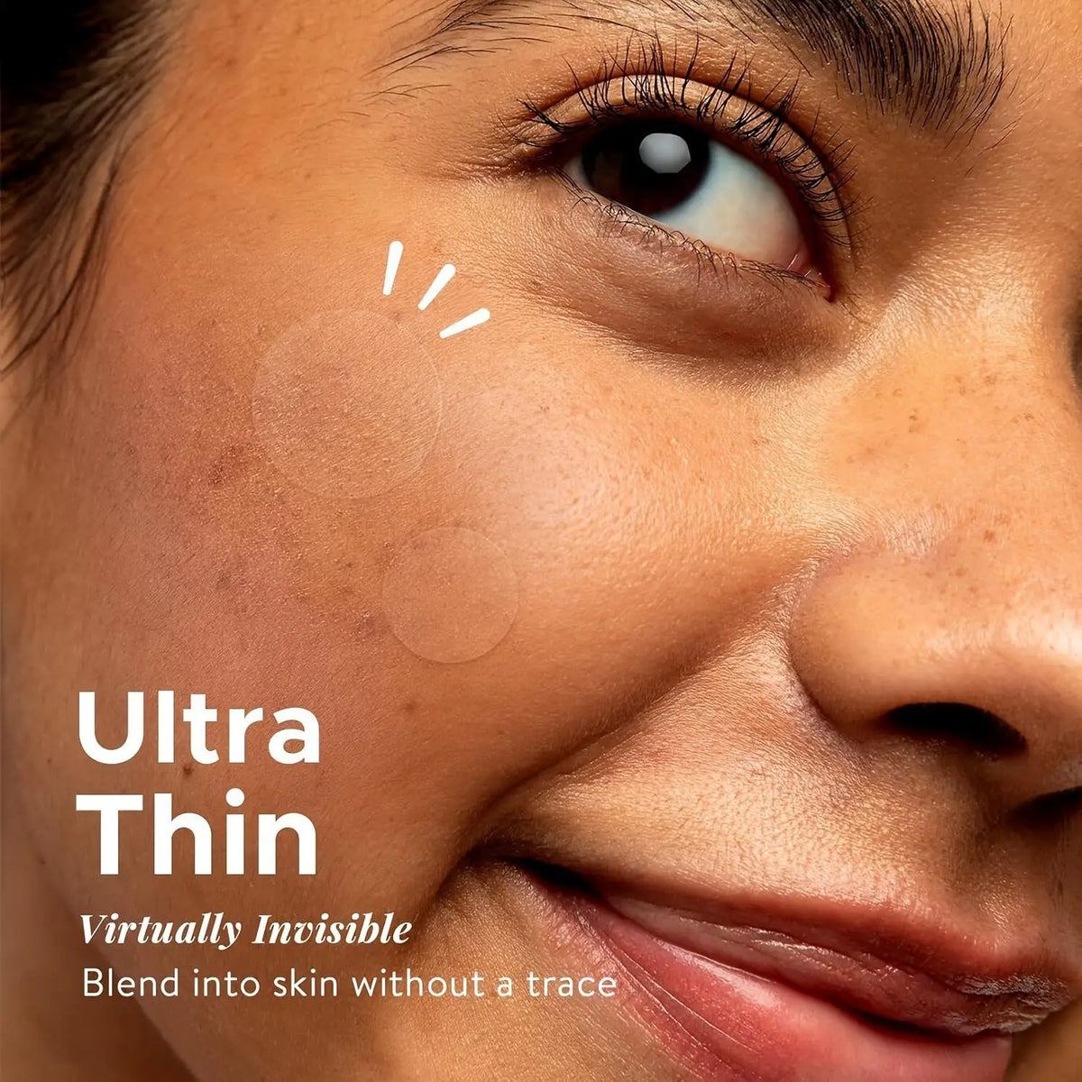200/400/800 Pieces Hydrocolloid Acne Patches - Invisible, High-Quality Pimple Stickers with Salicylic Acid & Tea Tree HIP