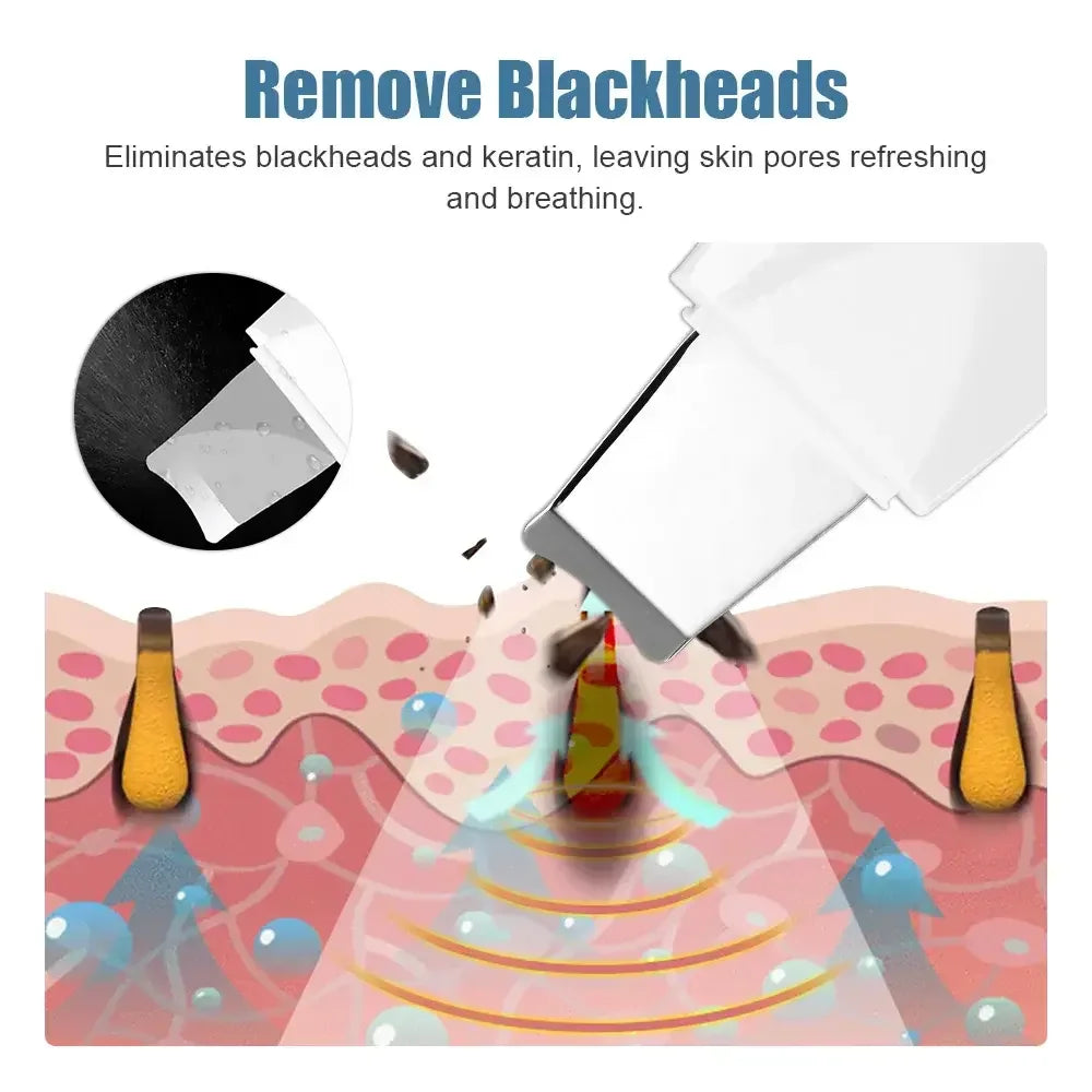 Vibrating Skin Scrubber Spatula – Blackhead & Pore Cleaner Facial Cleansing Device HIP