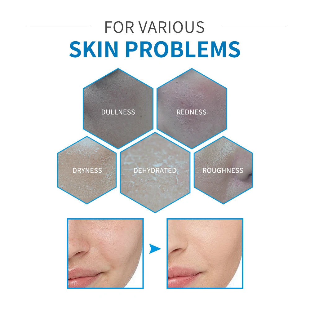 Hyaluronic Acid Skin Care Set Facial Serum Moisturizing Eye Cream Hydrating Repair Reduce Redness Dryness Anti‑Aging Face Care HIP