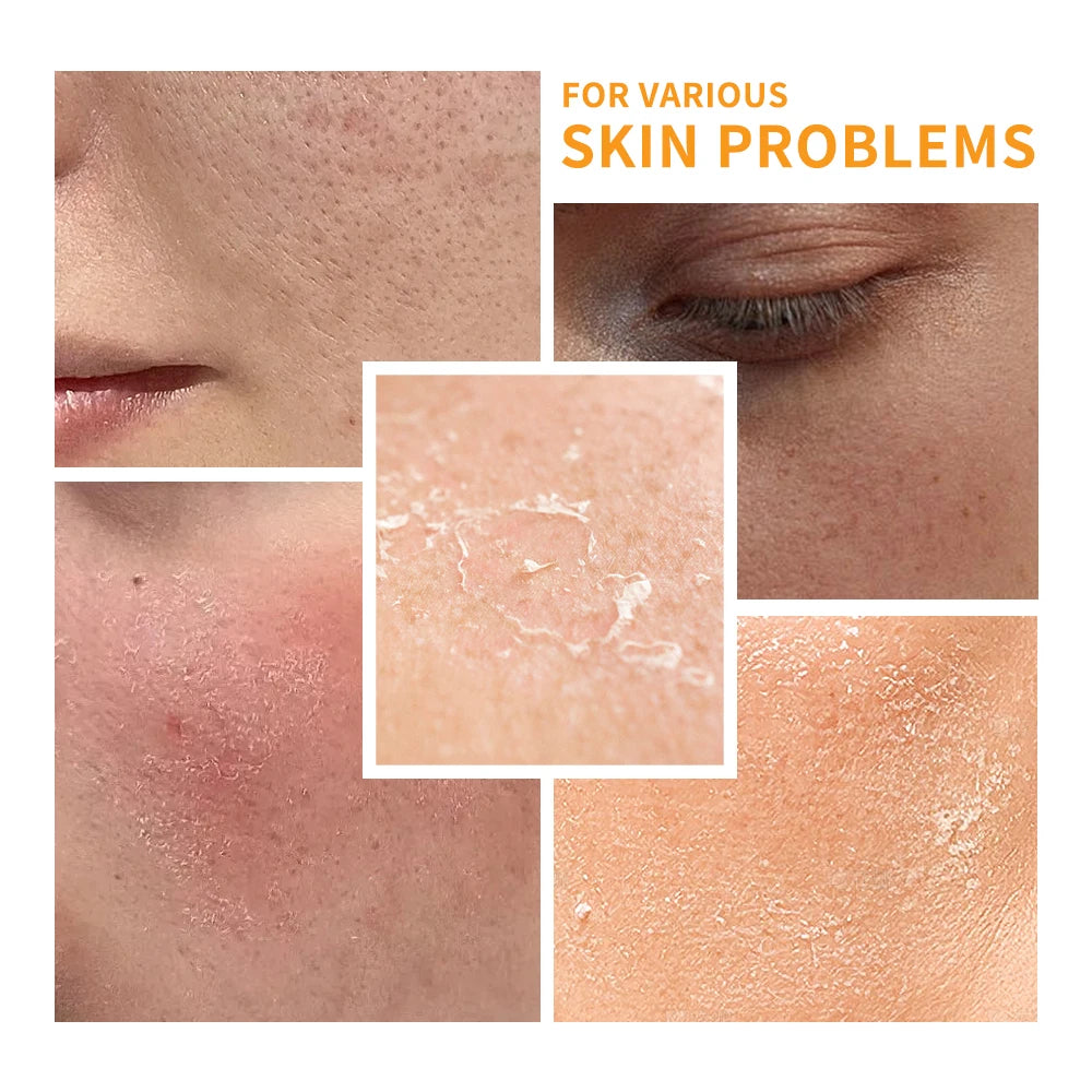 SPF 30 Vitamin C Moisturizer Protects Skin From UV Rays Hydrating Lotion Brightens Skin Nourishment Multiple Skin Care HIP