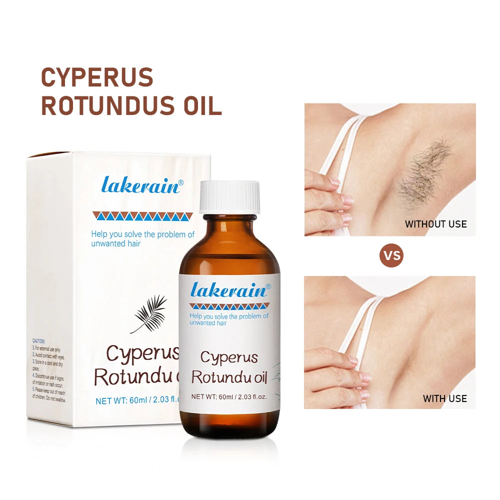 Inhibit Hair Growth 60ml Cyperus Rotundus Oil Nourish the Skin Ingredients are Safe Wide Scope of Application Solve Hair Dense HIP