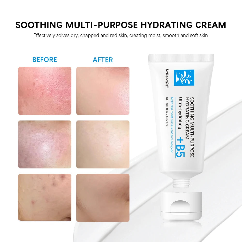 Soothing Multi-Purpose Hydrating Cream Reduces Redness Daily Helps Relieve Rough Cracked Skin Deep Skin Care HIP