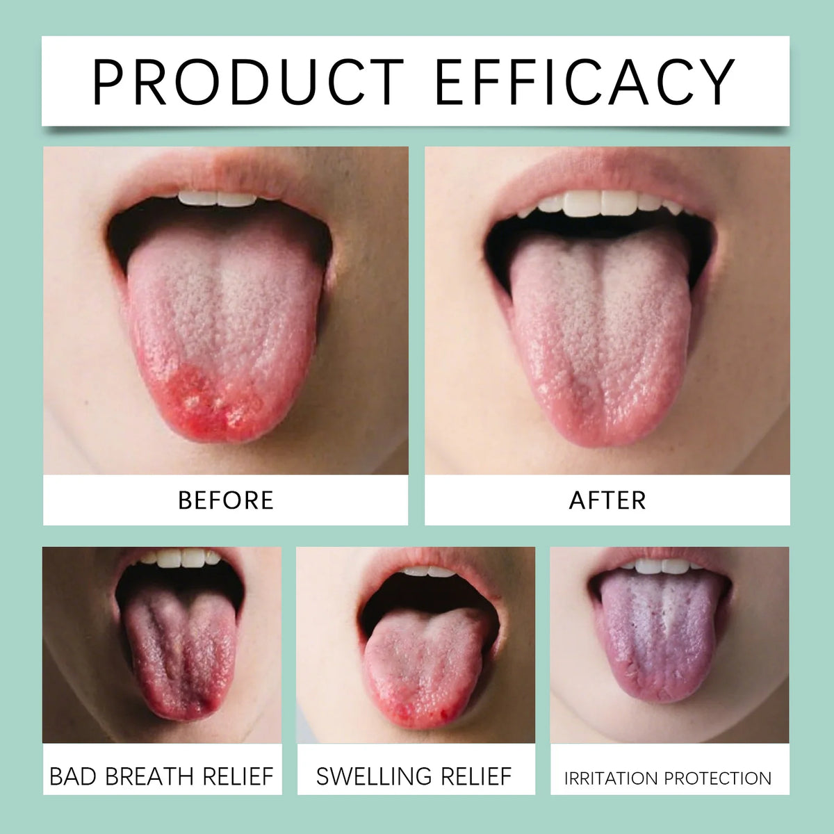 Tongue Care Fresh Breath Spray – Green Tea & Vitamin B1 Oral Breath Spray HIP