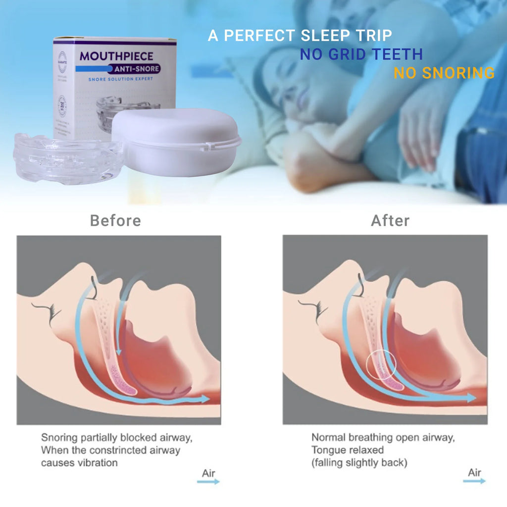 CAMMUO Adjustable Anti-Snoring Mouth Guard & Bruxism Guard Anti-Snoring Mouth Guard HIP