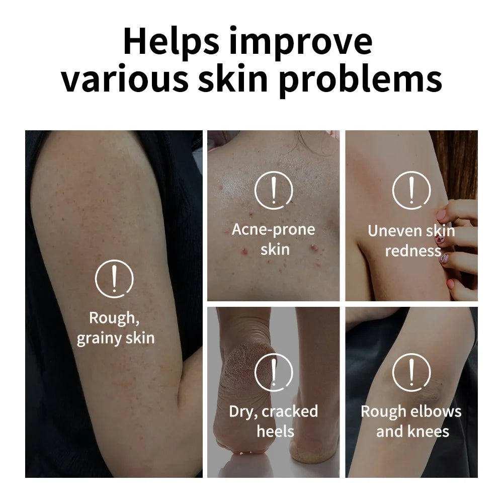 Body Effective Exfoliation Stick Glycolic Acid Exfoliating Deep Exfoliation Nourishing Moisture Deep Hydration Skincare HIP