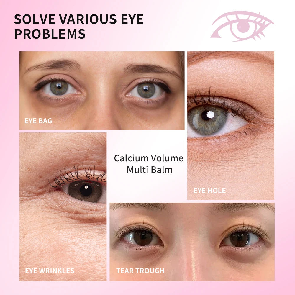 Calcium Collagen Vitamin D Eye Stick Balm Tightens Skin Care Anti Aging Anti Dark Circle Reduces Eye Bags Wrinkles Tear Trough HIP