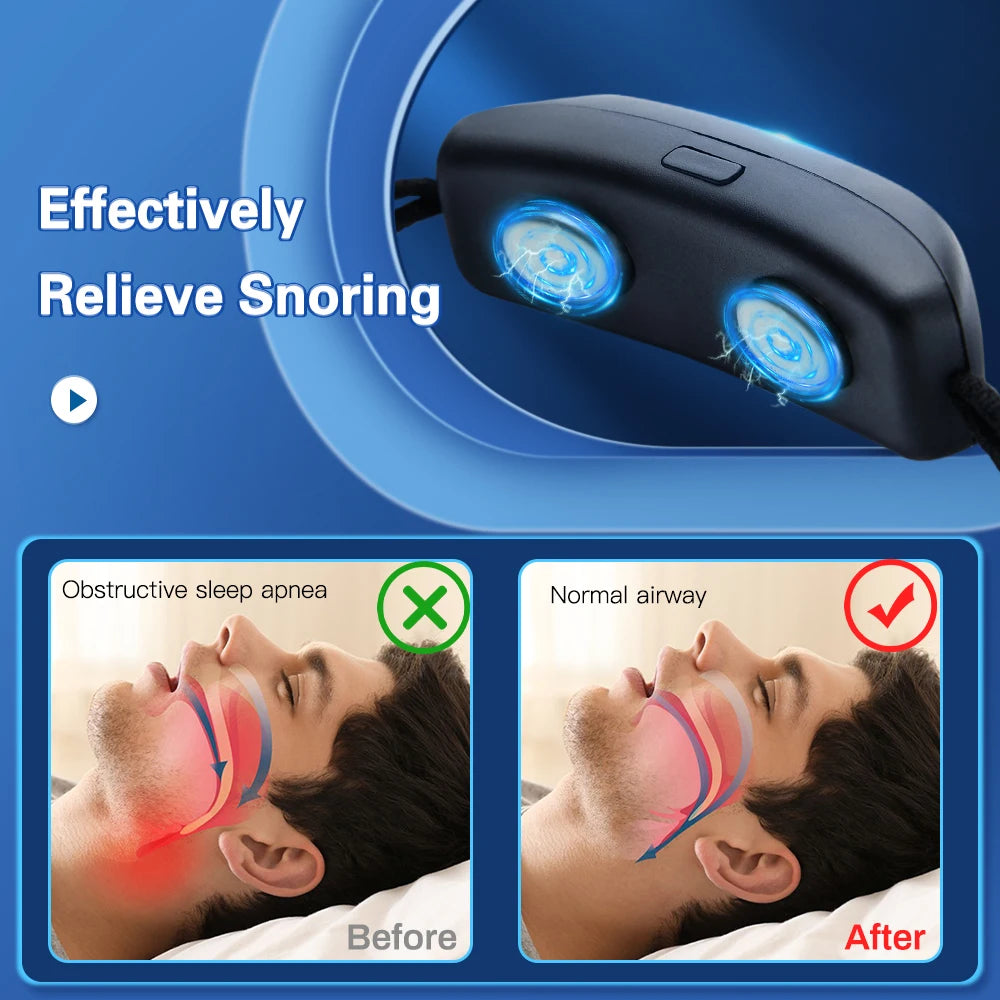 EMS Pulse Anti-Snoring Device – USB Smart Sleep Aid Anti-Snoring Device HIP