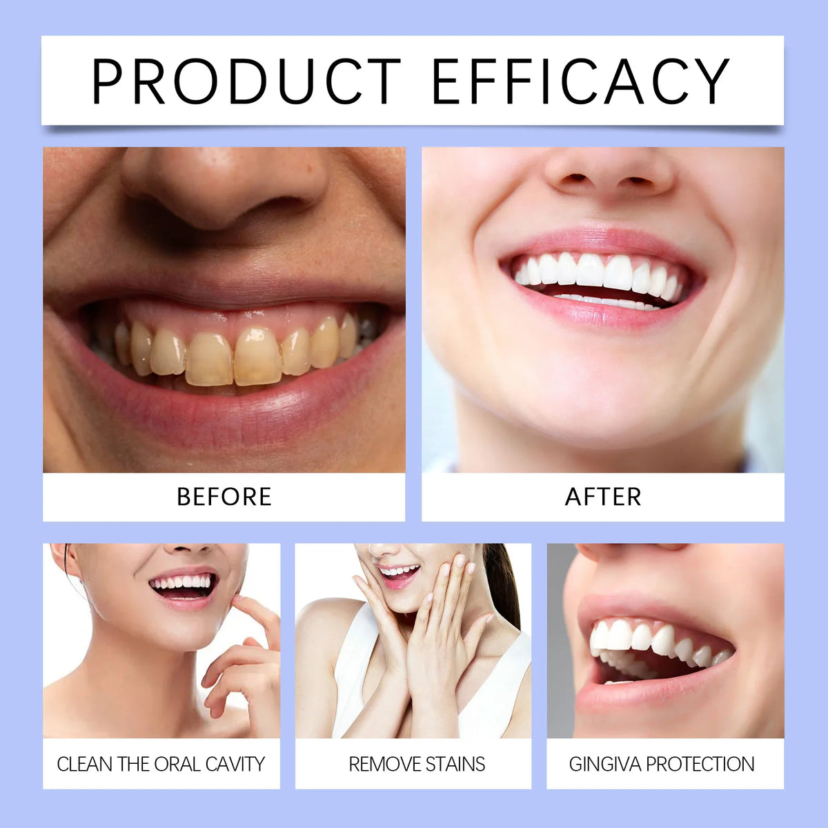 Gum Care Serum – Teeth Stain Cleaner & Enamel Protection Dental Care Serum HIP