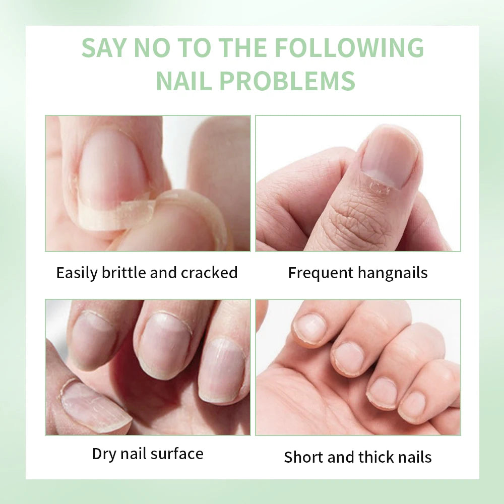 Nail Treat -Growth Nail Strengthener Healthy Strong Nail Growth Oil Help Splits Thin Nails Repair Manicure Nail Hardener Polish HIP