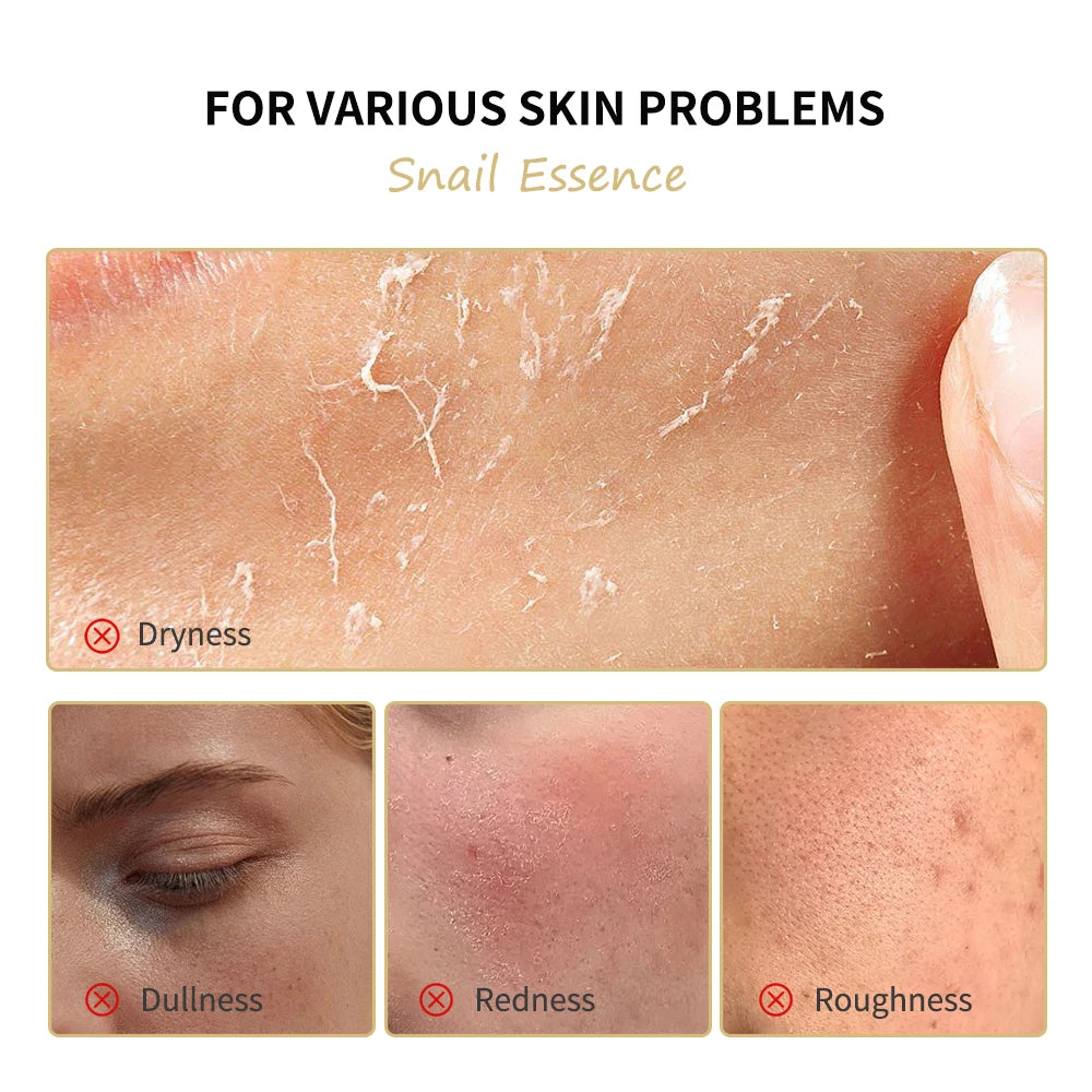 8Pcs Snail Essence Moisturizing Skin Care Set Cleansing Gel Toner Serum Eye Cream Cream Facial Mask Nourishing Repair Beauty Kit HIP