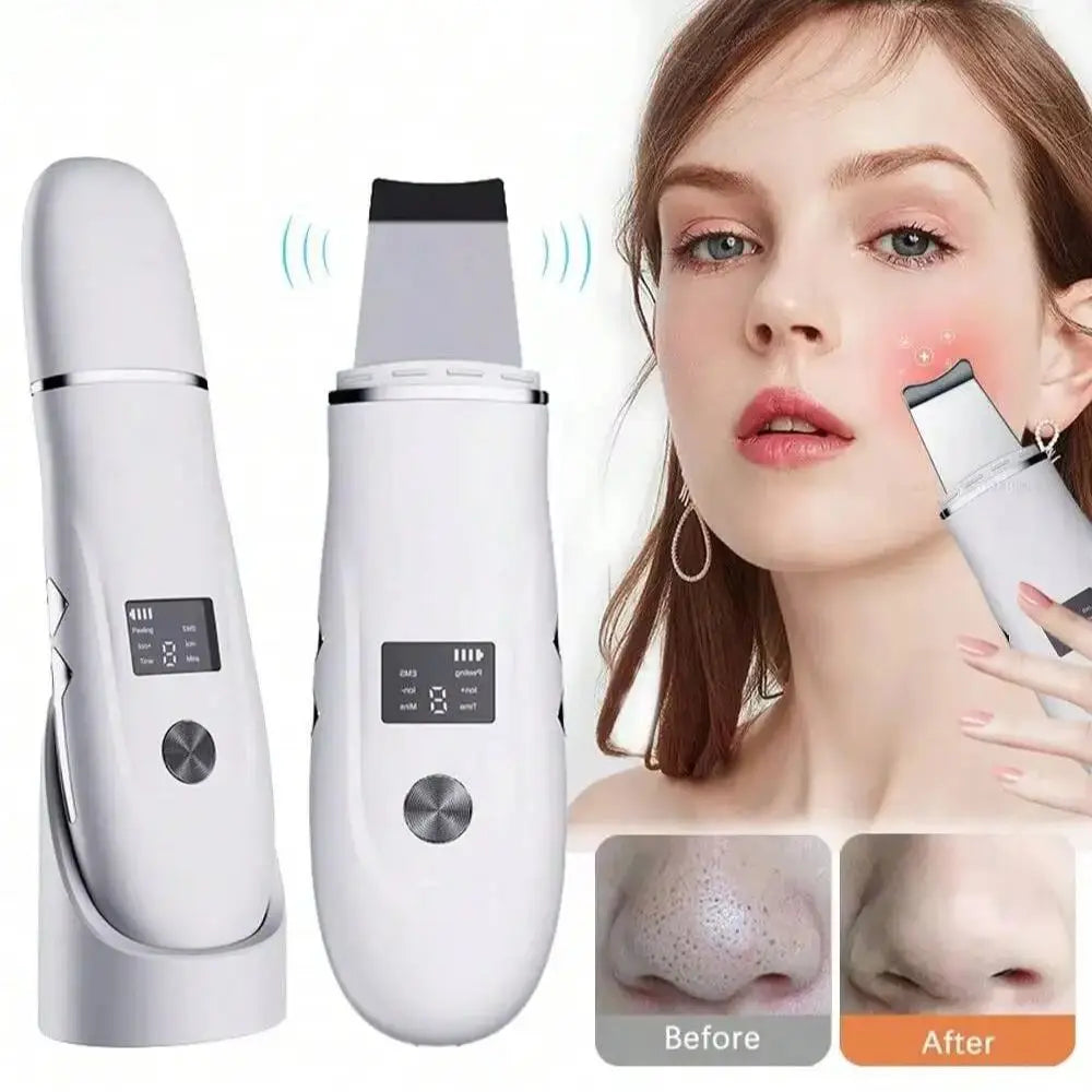 Ultrasonic Face Scrubber Spatula – Deep Pore Cleansing Device Facial Cleansing Device HIP WHITE