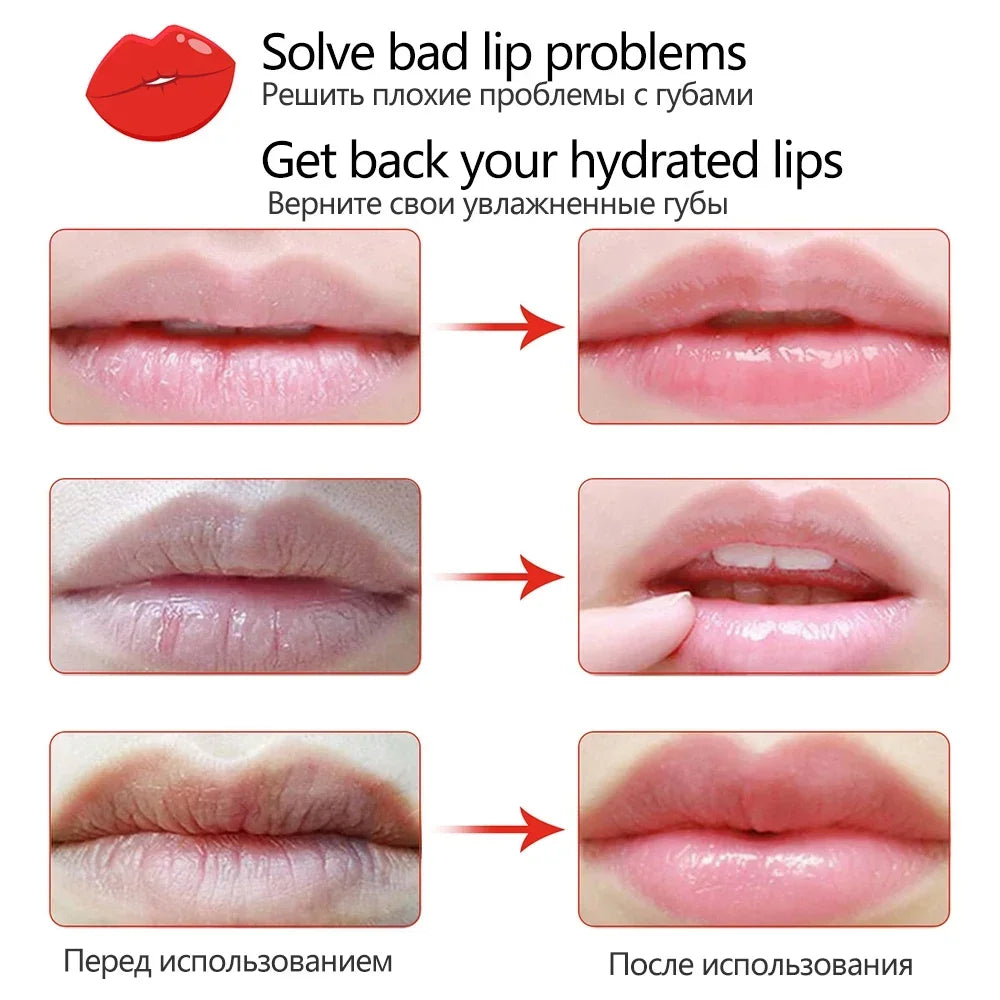 Vitamin C Lip Mask Patches – Moisturizing & Smoothing Lip Mask Patches HIP