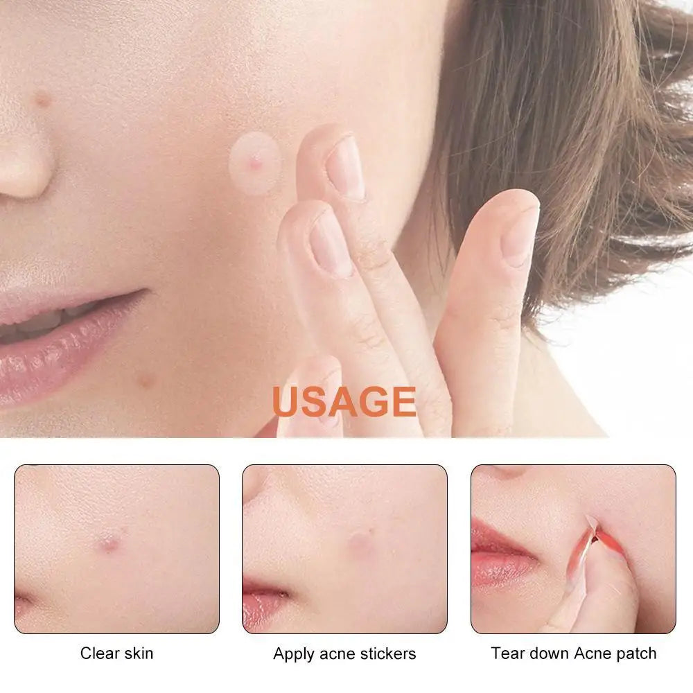 Hydrocolloid Acne Patch Waterproof Acne Removing PU Film Face Printing Spots Marks Invisible Acne Cleansing Patch HIP