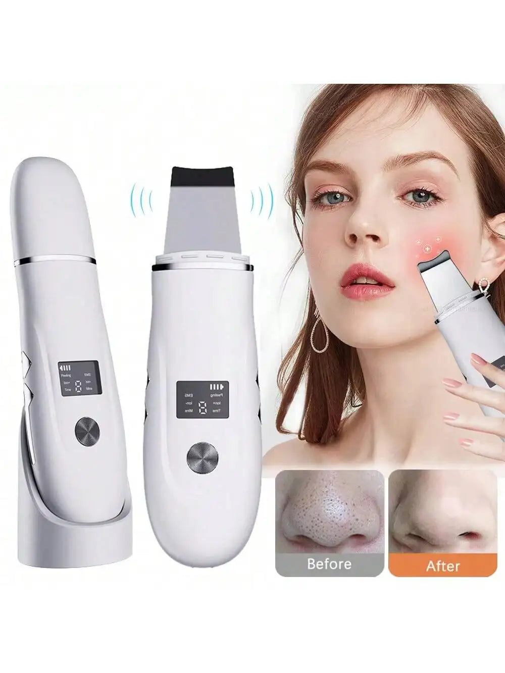 Ultrasonic Face Scrubber Spatula – Deep Pore Cleansing Device Facial Cleansing Device HIP