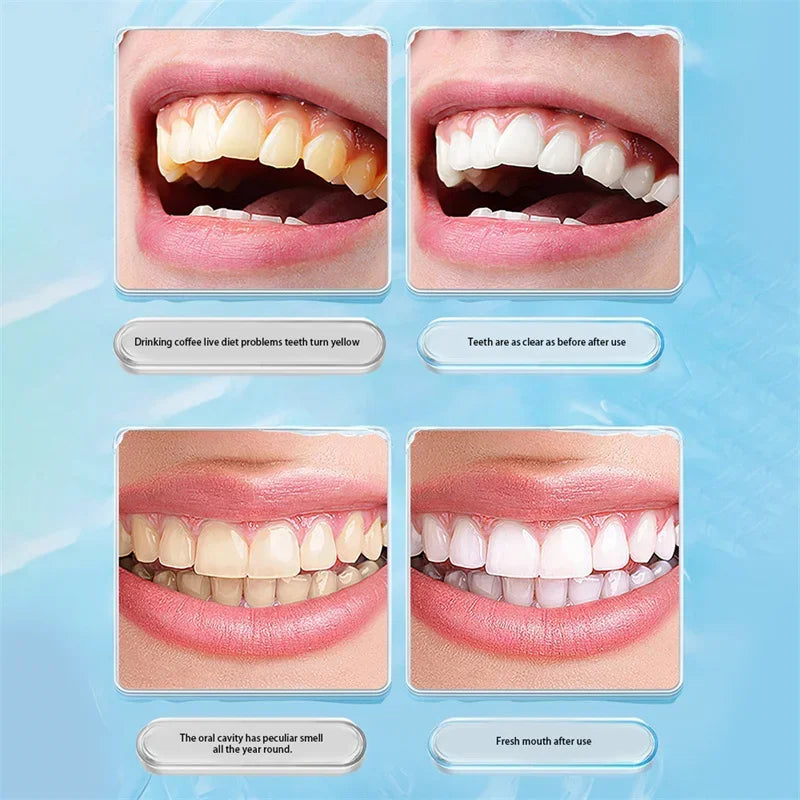 L-Shaped Interdental Toothbrush – Deep Stain Cleaning Brush Interdental Toothbrush HIP