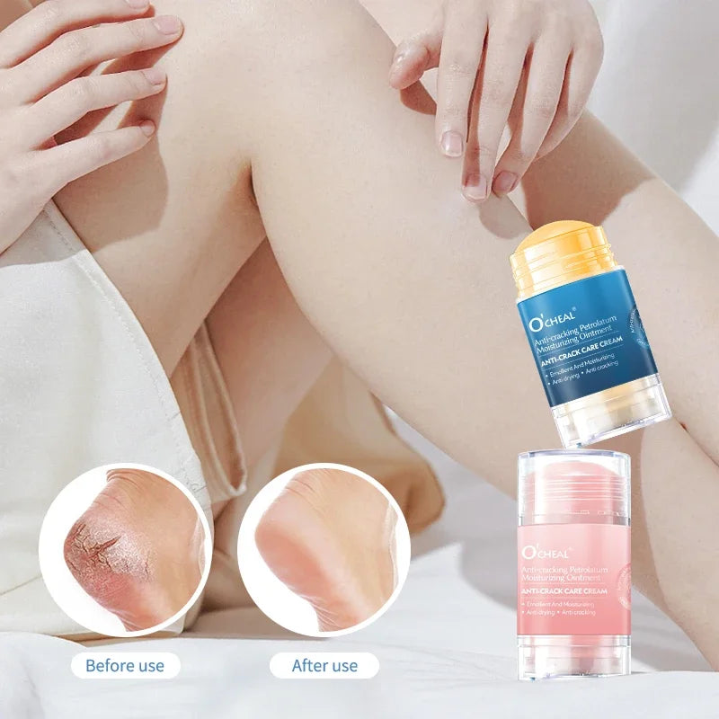 Ocheal Hand & Foot Moisturizing Cream – Hydrate & Repair Skin Hand & Foot Cream HIP