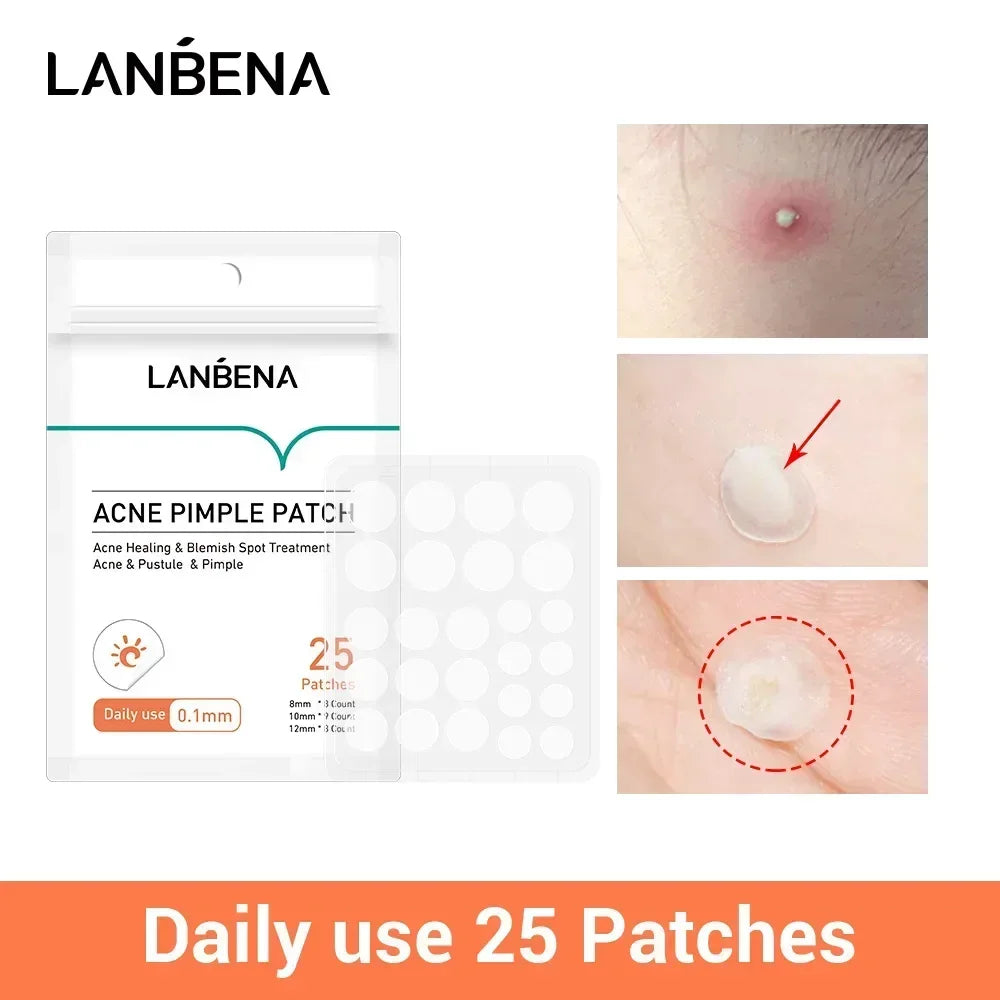 LANBENA Acne Pimple Patch 25pc – Invisible Blemish Stickers Acne Pimple Patch HIP