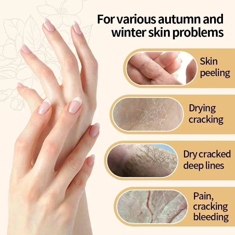 Kojic Acid Hand Cream – Brightening & Moisturizing | 30g Brightening Hand Cream HIP