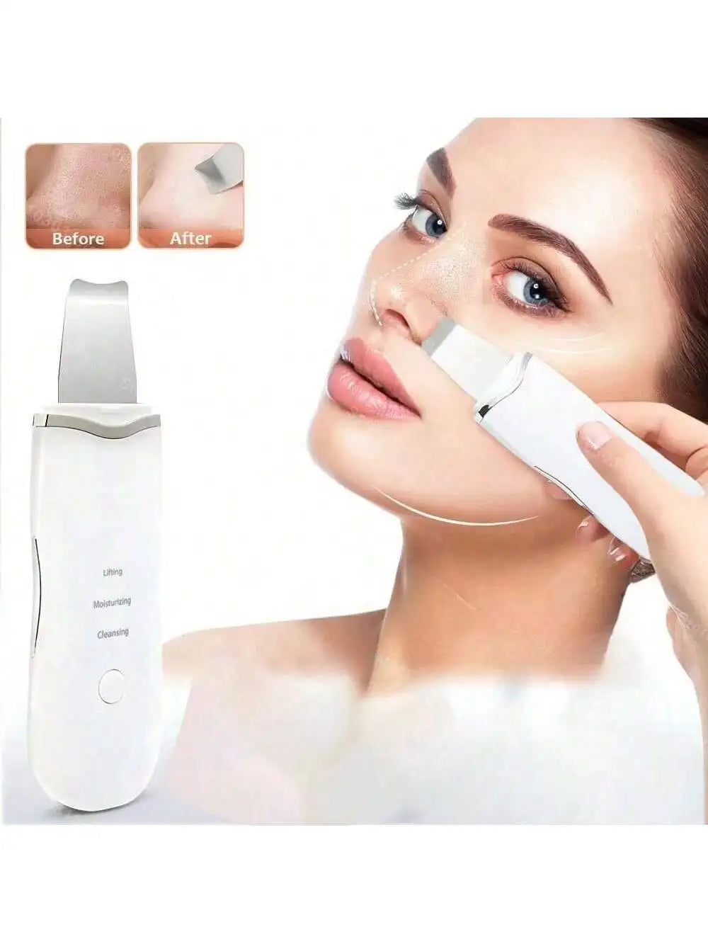 Ultrasonic Skin Scraper – Deep Pore Cleansing Face Device Facial Cleansing Device HIP