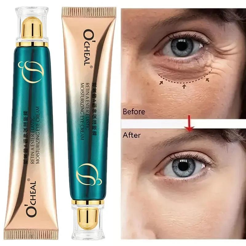 OCHEAL Retinol Eye Cream – Dark Circles, Fine Lines 30g Retinol Eye Cream HIP