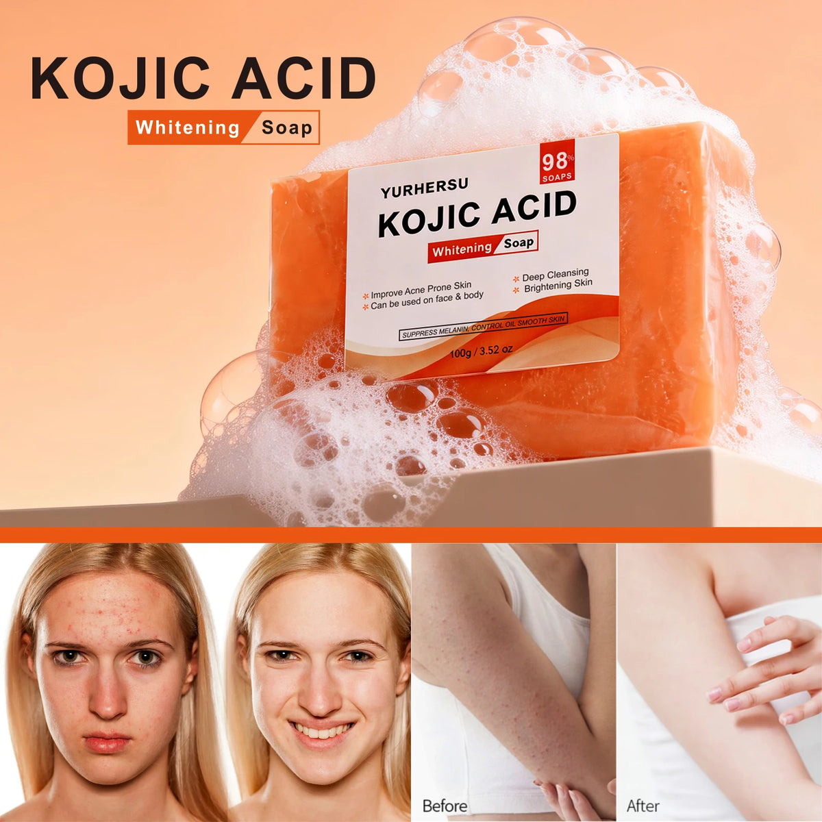 Kojic Acid Brightening Face Soap – Natural Skin Moisturizing Brightening Facial Soap HIP