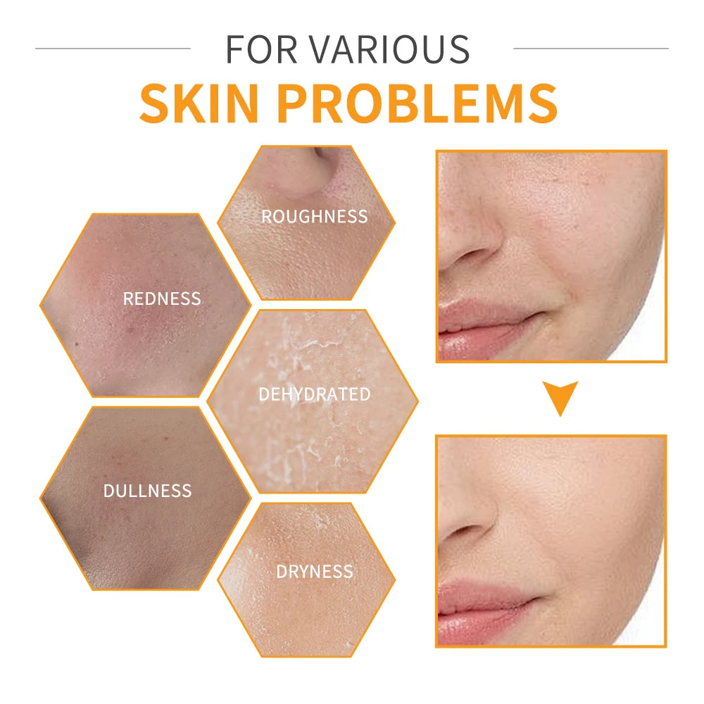 6pcs Vitamin C SkinCare Set Facial Cleanser Toner Serum Eye Cream Serum Moisturizer Eye Cream Gift for Women Girl HIP