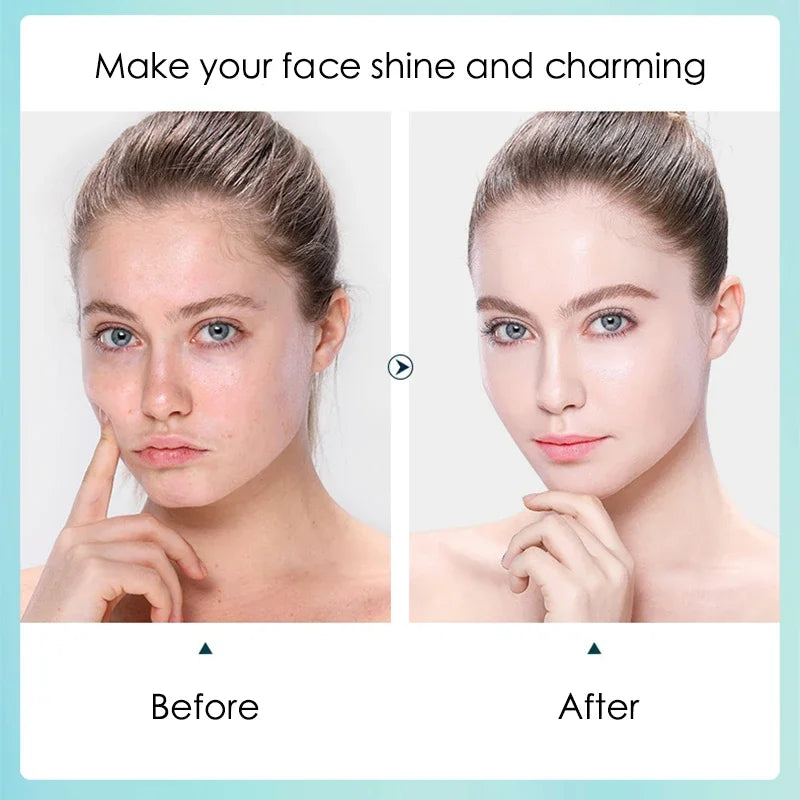 5-Pack Hyaluronic Acid Sheet Masks – Hydrate & Refine Pores Hydrating Sheet Mask HIP