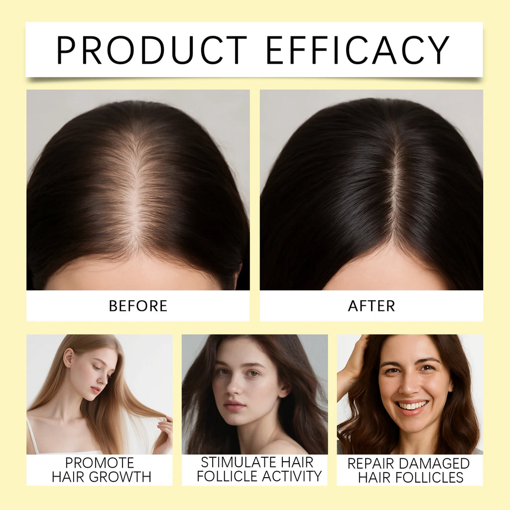 Rosemary Keratin Shampoo – Oil Control & Volumizing | 100ml Keratin Shampoo HIP