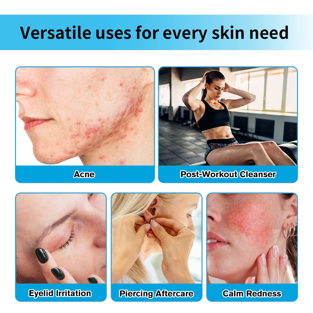 Hypochlorous Acid Facial Spray Reduce redness swelling acne Versatile uses for every skin Calm Redness Eyelid lrritation Care Sk HIP