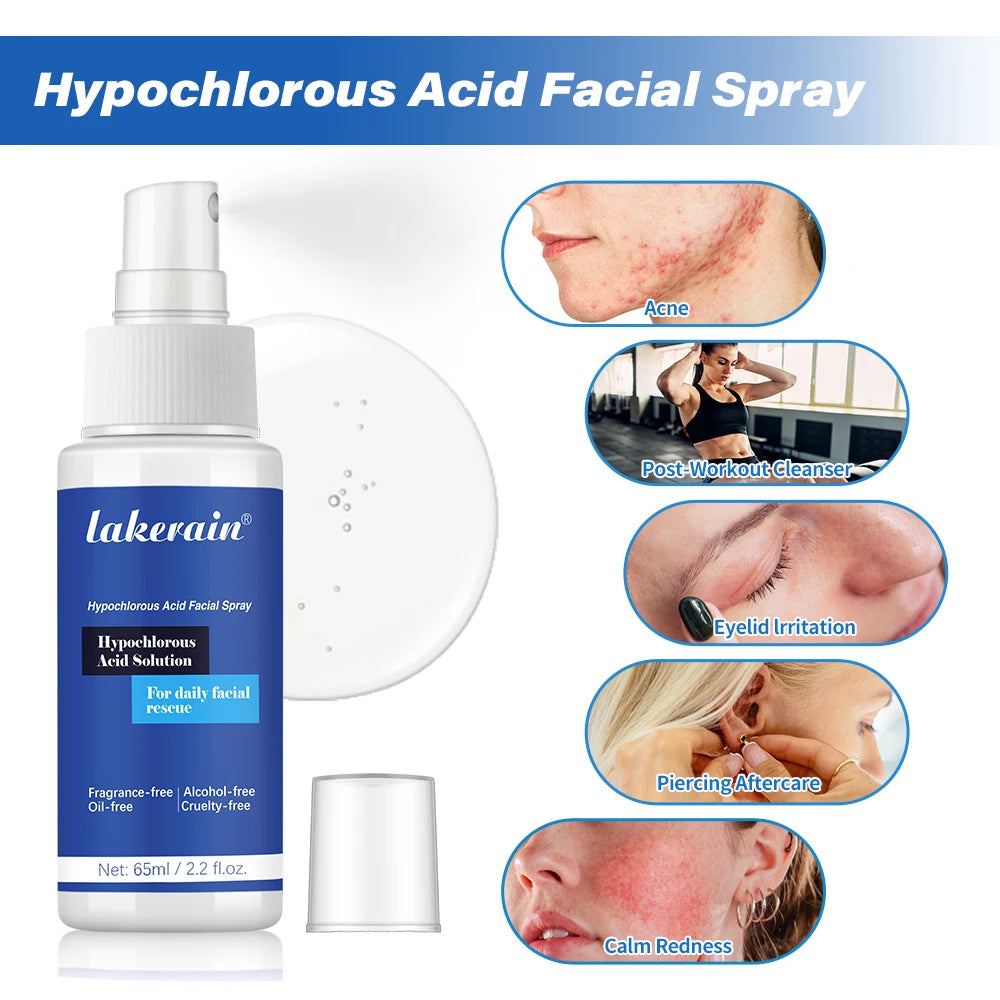Hypochlorous Acid Facial Spray Reduce redness swelling acne Versatile uses for every skin Calm Redness Eyelid lrritation Care Sk HIP Default Title