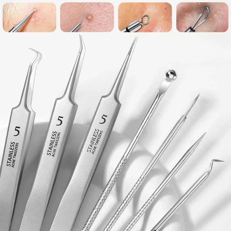 Blackhead & Ingrown Hair Removal Tweezer Kit – 3/8 Pcs Skin Care Tool Set HIP