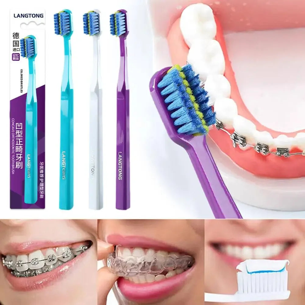 RUZOFO Orthodontic Toothbrush – Soft Bristle for Braces Orthodontic Toothbrush HIP