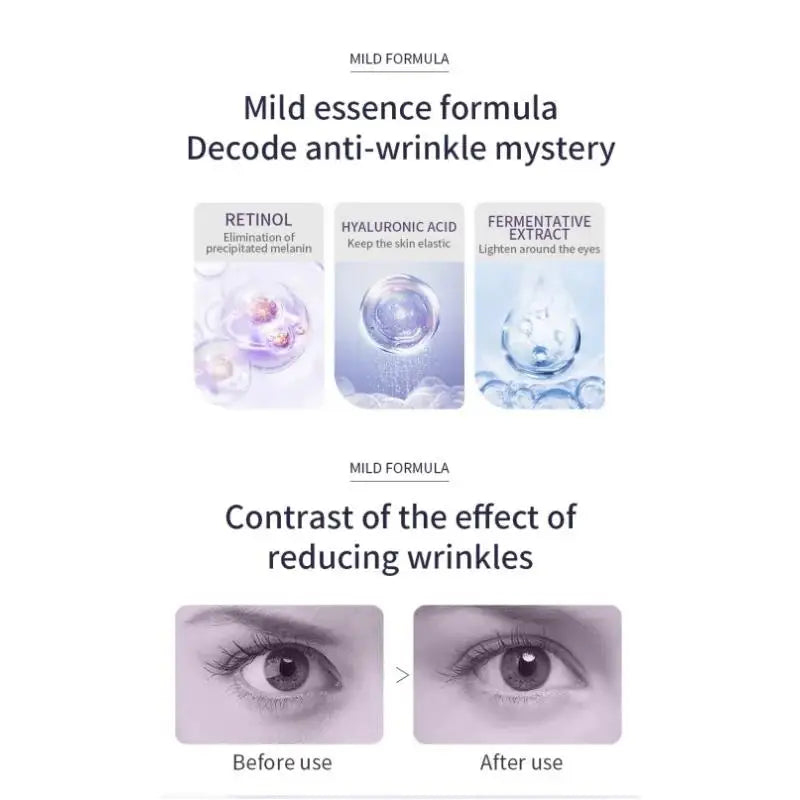 OCHEAL Hyaluronic Acid Roller Eye Cream – Wrinkles & Dark Circles Roller Eye Cream HIP