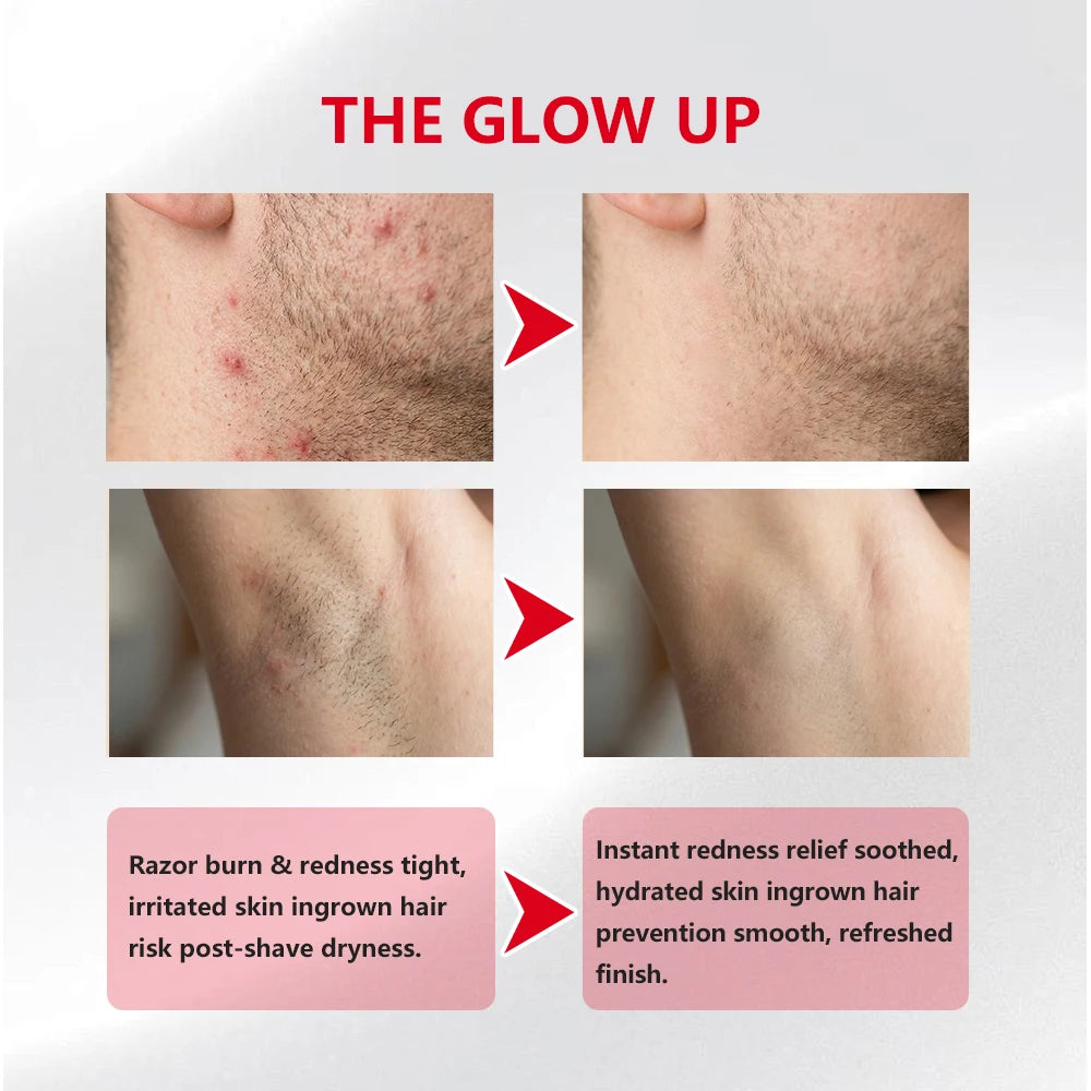 Ingrown Hair Pads Aftershave Treatment Pads to Help Prevent Razor Bumps for Men & Women - Exfoliate Underarms & Bikini Area HIP
