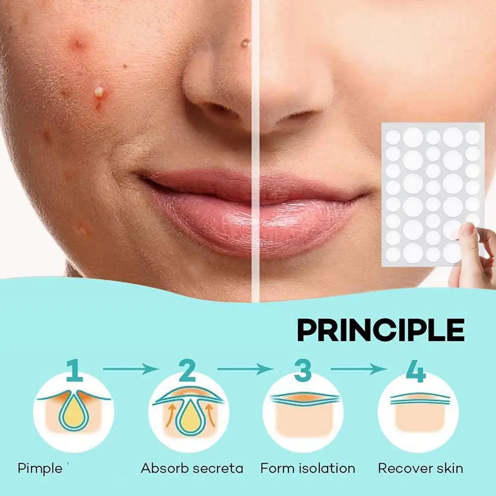 Hydrocolloid Acne Patch Waterproof Acne Removing PU Film Face Printing Spots Marks Invisible Acne Cleansing Patch HIP