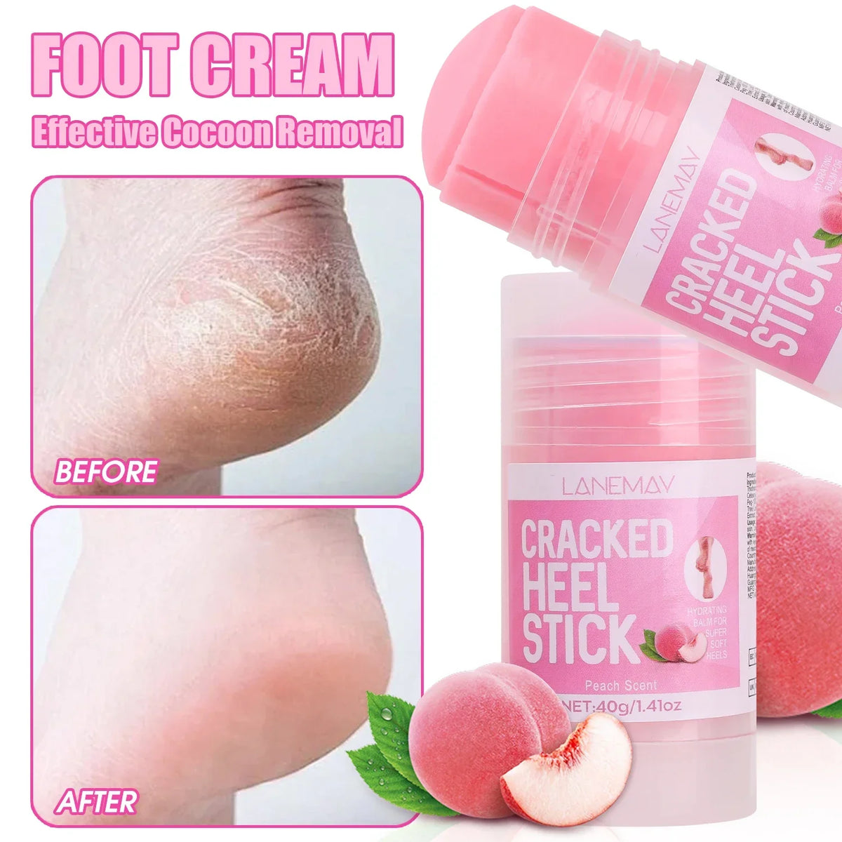 Ultra-Hydrating Foot & Hand Cream – Softens Calluses & Heels Foot & Hand Cream HIP