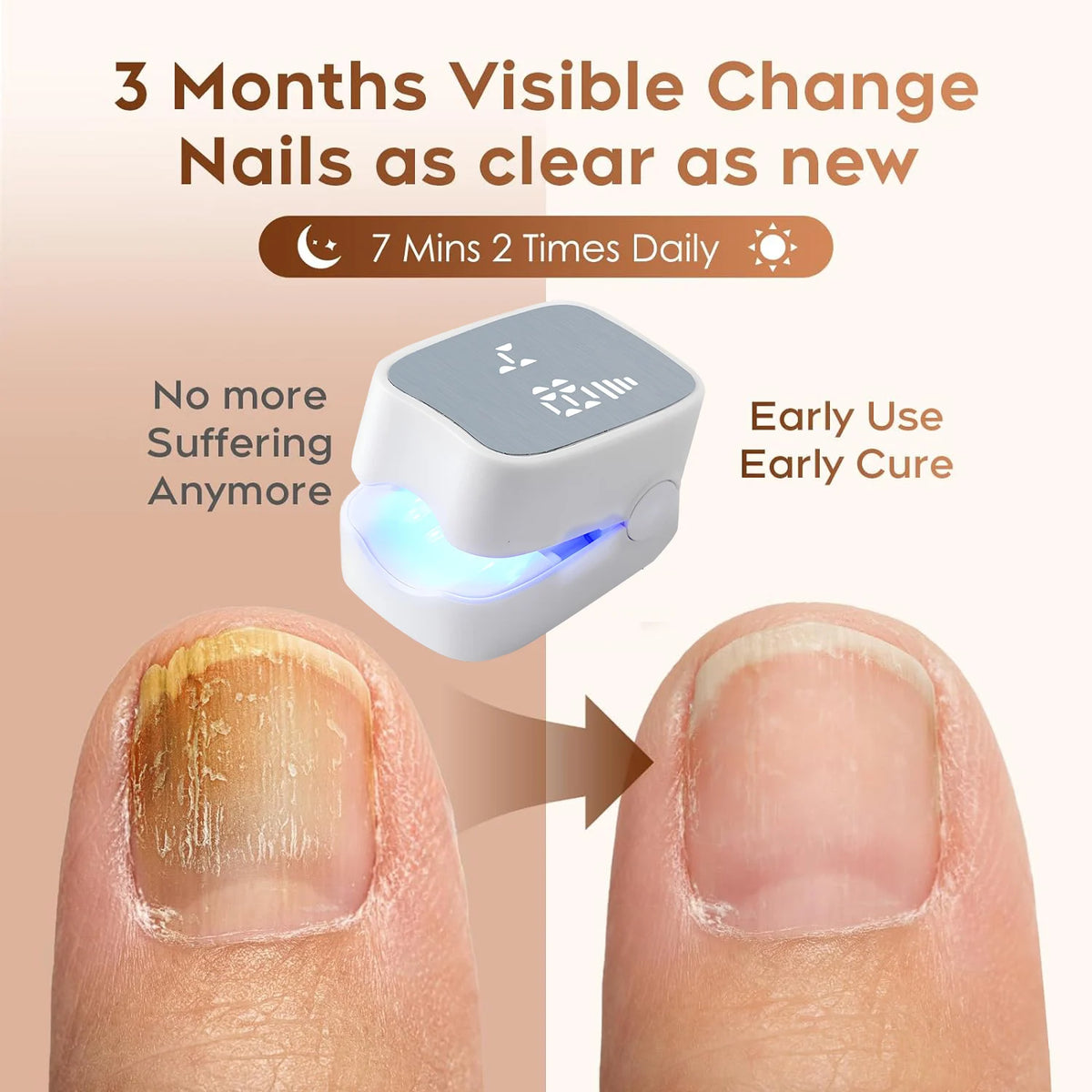IR & Blue Light Nail Therapy Device | USB Rechargeable Tool Nail Therapy Device HIP