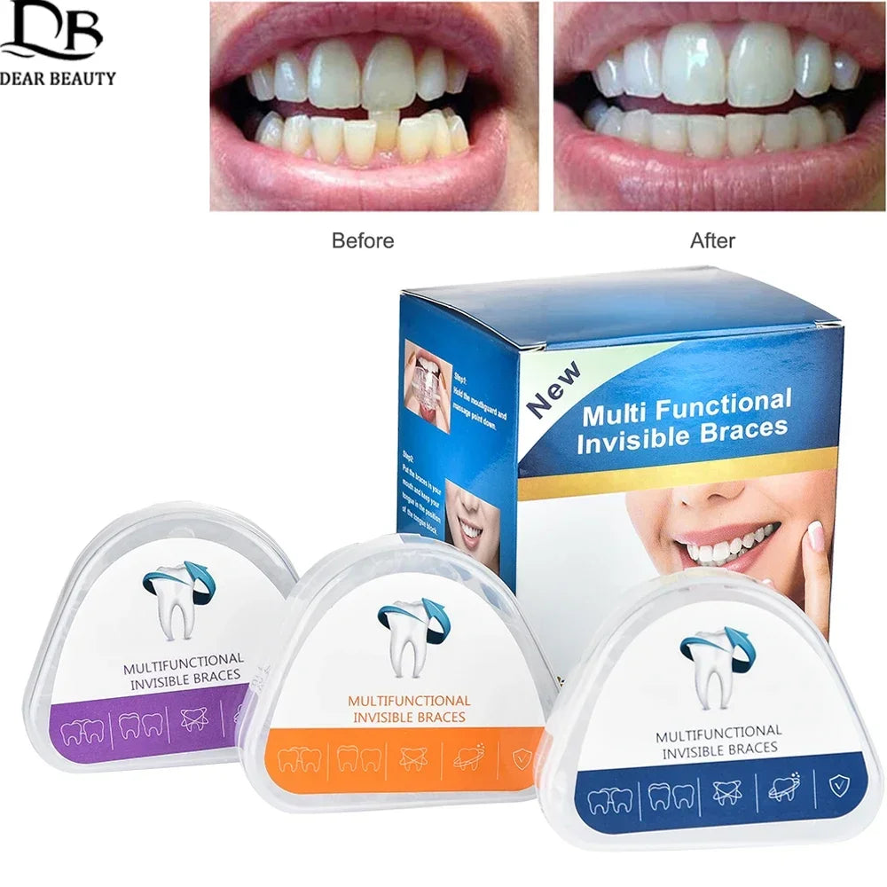 3-Stage Transparent Teeth Trainer Braces for Adults | Set of 3 Teeth Alignment Trainer HIP