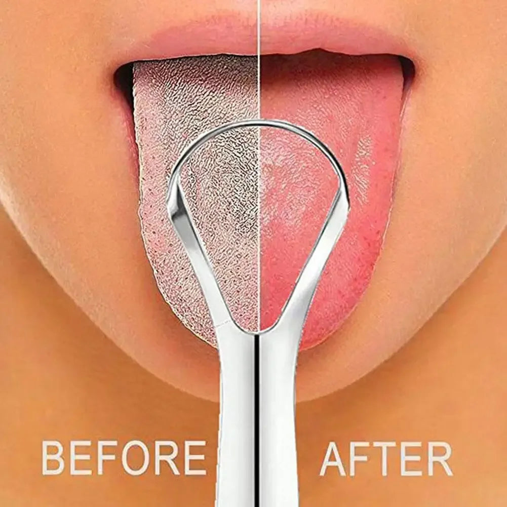 Stainless Steel Tongue Scraper Set | Fresh Breath Oral Care Tongue Scraper HIP