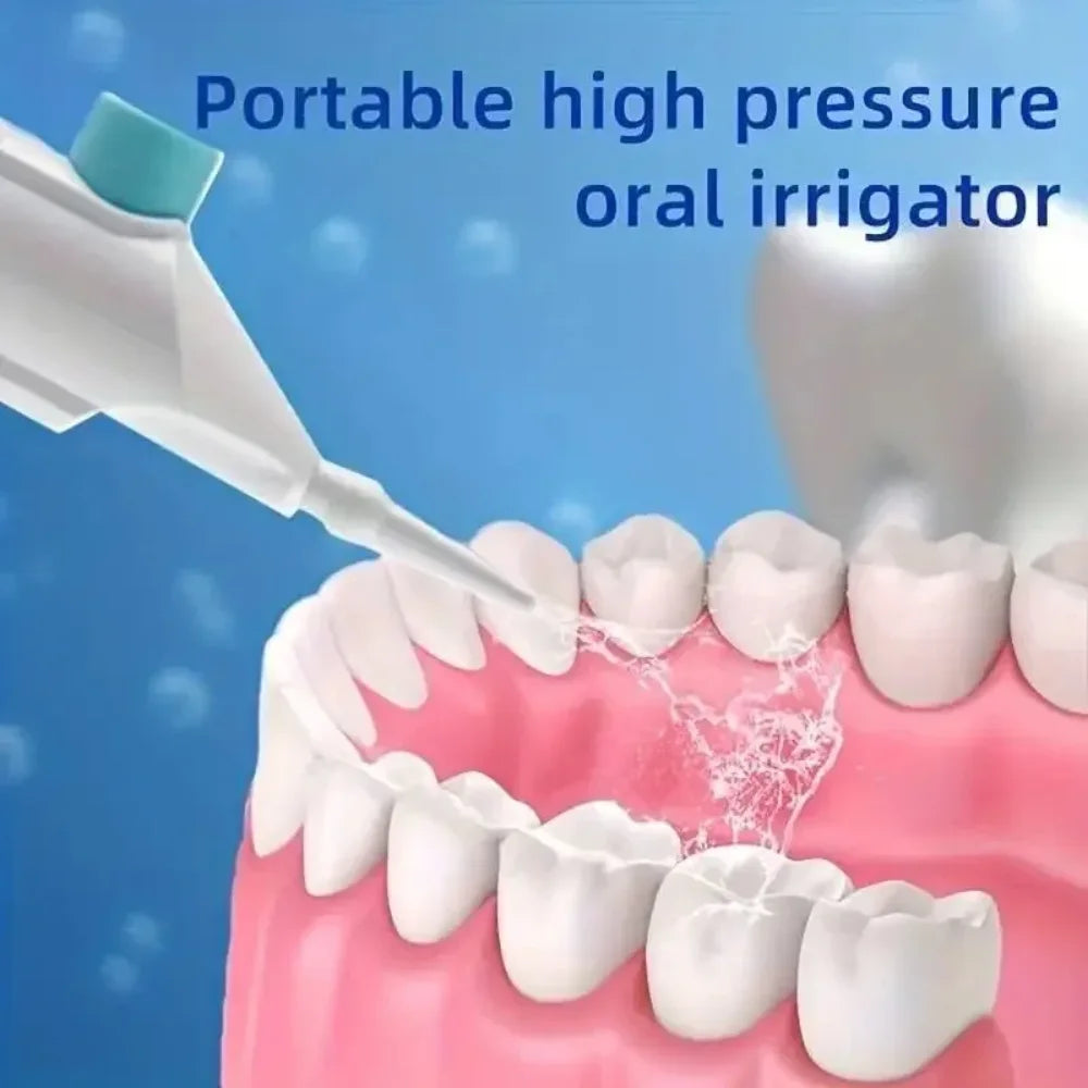 Portable Manual Water Flosser – Travel Oral Irrigator Manual Water Flosser HIP