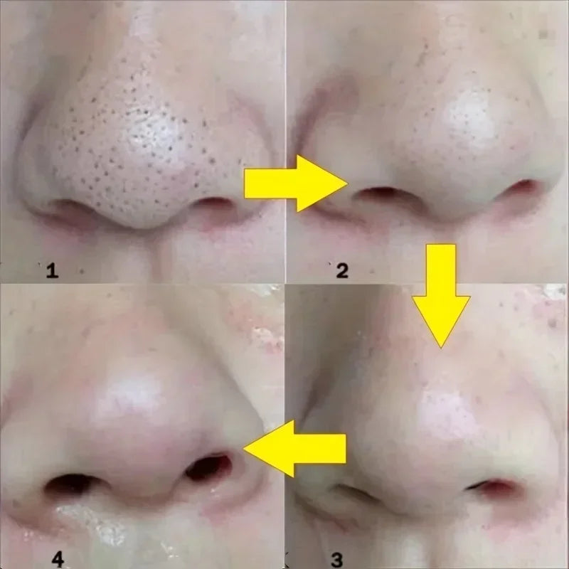 Blackhead Nose Strips – Deep Cleansing Pore Strips 10–100pk Nose Pore Strips HIP