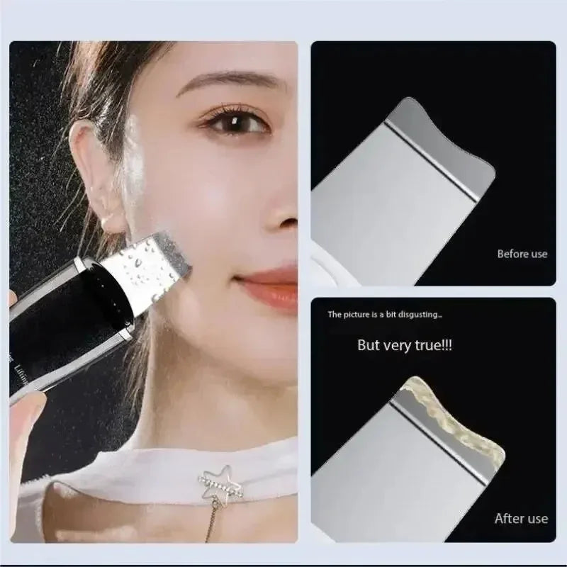 RUZOFO Blackhead Remover & Pore Cleansing Facial Device Facial Cleansing Device HIP