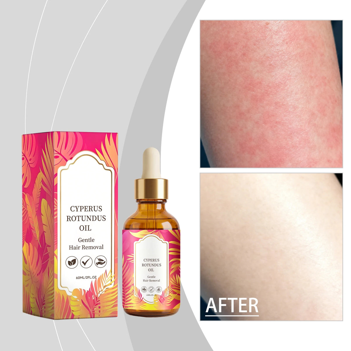 Cyperus Rotundus Oil Hair Growth Inhibitor Body Serum 60ml Hair Growth Inhibitor Oil HIP