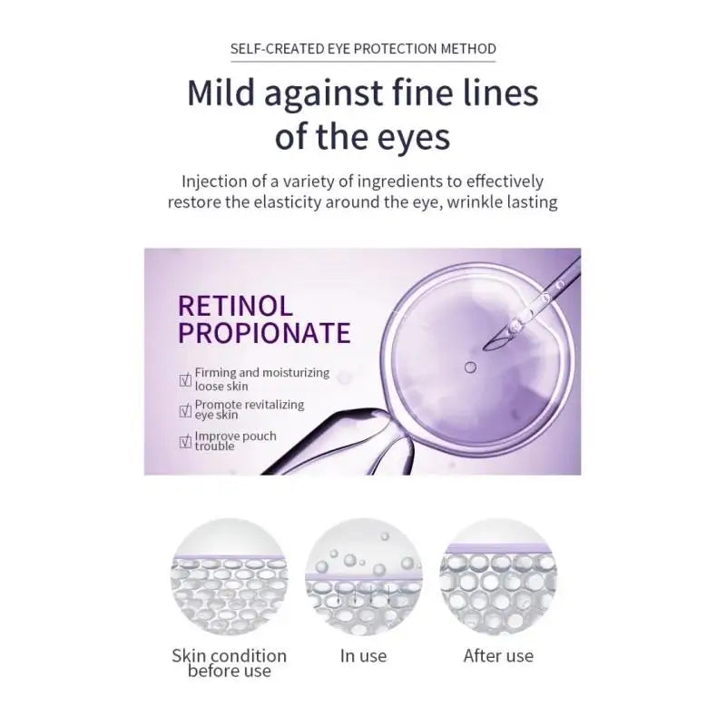 OCHEAL Hyaluronic Acid Roller Eye Cream – Wrinkles & Dark Circles Roller Eye Cream HIP